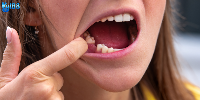 Khám phá việc nằm mơ rụng răng